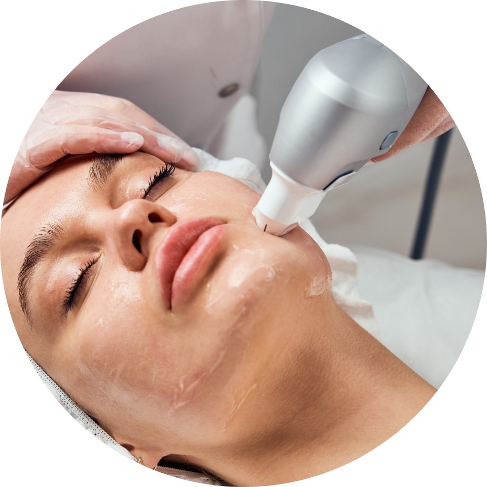 Ultraformer santa felicidade